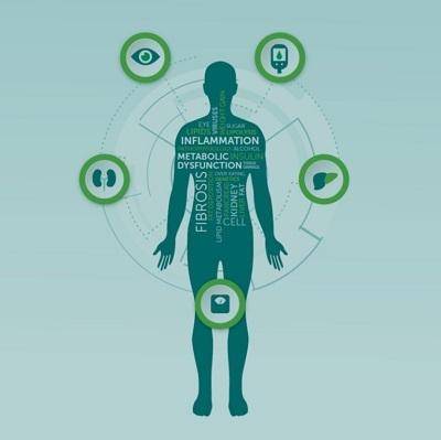 Card Image CM Infographic 2
